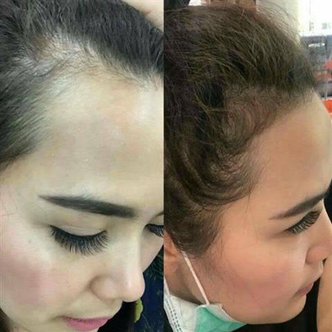 NEOHAIR LOTION ทุกปัญหาของเส้นผมจะหมดไป รูปที่ 4