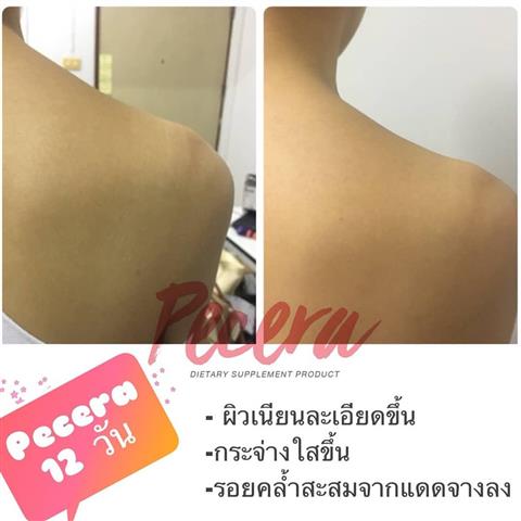อาหารเสริม 