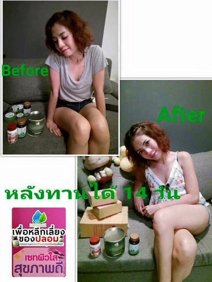 น้ำมันมะพร้าวสกัดเย็น รูปที่ 5