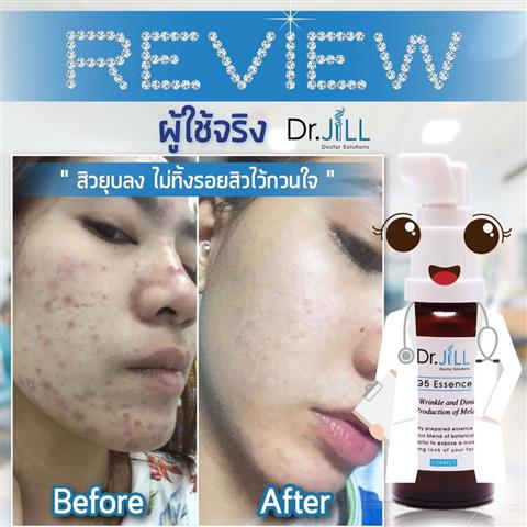 Dr.Jill G5 Essence เอสเซ้นท์น้ำนมเข้มข้น ที่มีประสิทธิภาพสูง  แต่มีเนื้อสัมผัสที่บางเบา รูปที่ 4