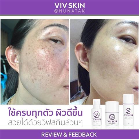 จำหน่าย เครื่องสำอางวิฟสกิน ผลิตภัณฑ์บำรุงผิว Skin Care  คุณภาพสูงระดับพรีเมียม รูปที่ 6