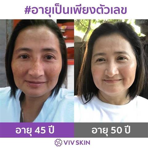 จำหน่าย เครื่องสำอางวิฟสกิน ผลิตภัณฑ์บำรุงผิว Skin Care  คุณภาพสูงระดับพรีเมียม รูปที่ 4