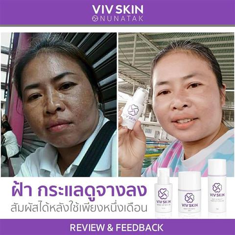 จำหน่าย เครื่องสำอางวิฟสกิน ผลิตภัณฑ์บำรุงผิว Skin Care  คุณภาพสูงระดับพรีเมียม รูปที่ 5