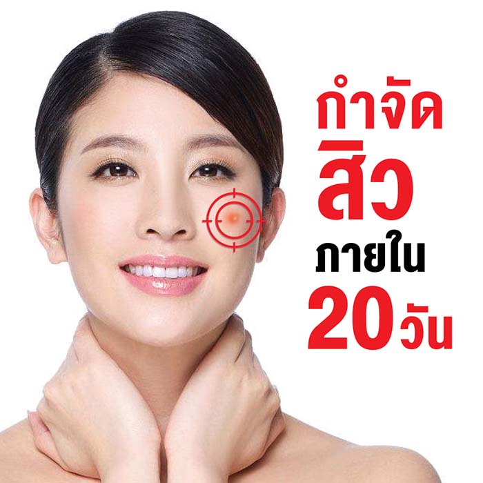 บอกลาทุกปัญหาสิว เอินเวย์ มีทางออก รูปที่ 3