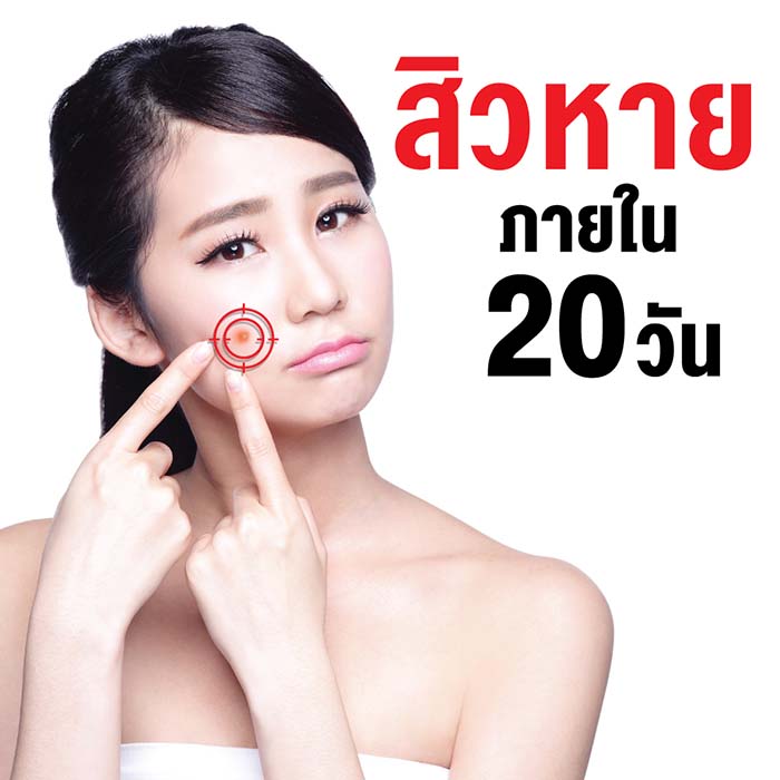 บอกลาทุกปัญหาสิว เอินเวย์ มีทางออก รูปที่ 4