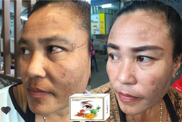 จิมบาน่าซีตรัง อาหารเสริมสุขภาพสมุนไพรบำรุง ดวงตา รูปที่ 7