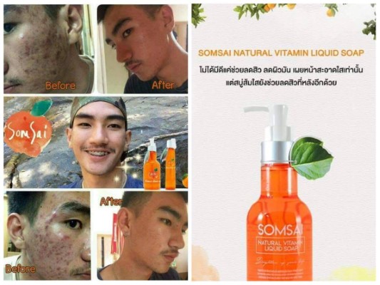 จำหน่ายเครื่องสำอาง อาหารเสริม ของแท้ ได้ราคาส่งตั้งแต่ชิ้นแรก  สั่งมากกว่า10ชิ้น  ส่งฟรีเคอรี่ รูปที่ 6