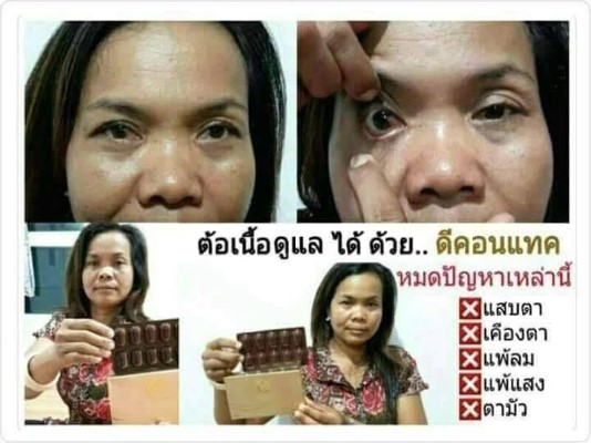 อาหารเสริมเพื่อดวงตา ดีคอนแทค D-contact ขจัดทุกปัญหาของดวงตาได้อย่าง ชัดเจนด้วย รูปที่ 5