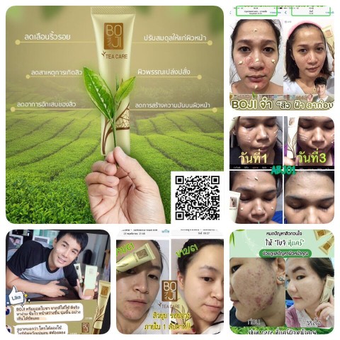 HIRA BLUE Water Cream ไฮร่าบลู เติมความชุ่มชื่นให้แก่ผิว บำรุงผิวให้เปล่งปลั่ง  กระจ่างใส รูปที่ 5