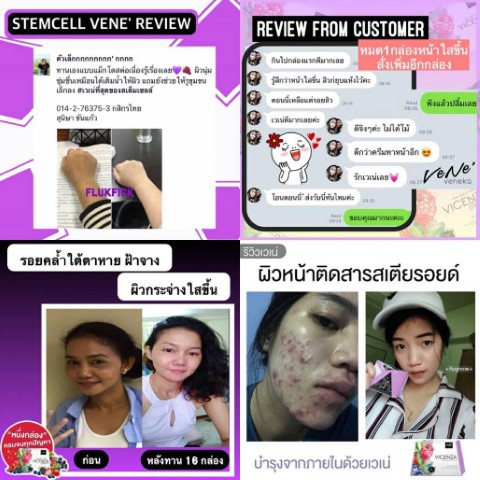 WP หุ่นสวยผิวใส ชนะเลิศ!!! อาหารเสริมลดน้ำหนัก  และอาหารเสริมผิวใสออร่า รูปที่ 5