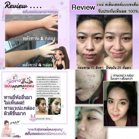 WP หุ่นสวยผิวใส ชนะเลิศ!!! อาหารเสริมลดน้ำหนัก  และอาหารเสริมผิวใสออร่า รูปที่ 7