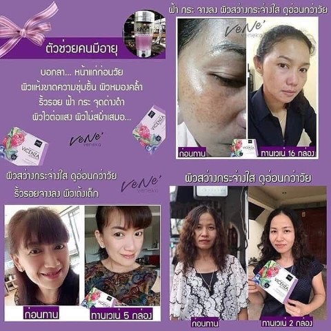 Vene Veneka เวเน่ เวเนก้า ผิวสวย สร้างผิวขาวฉ่ำ หน้าเด้งฟู Vicenza  antioxidants รูปที่ 5