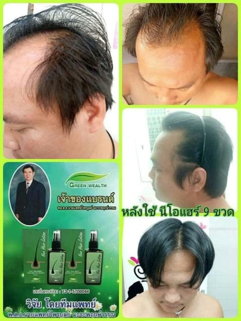 Vene Veneka เวเน่ เวเนก้า ผิวสวย สร้างผิวขาวฉ่ำ หน้าเด้งฟู Vicenza  antioxidants รูปที่ 7