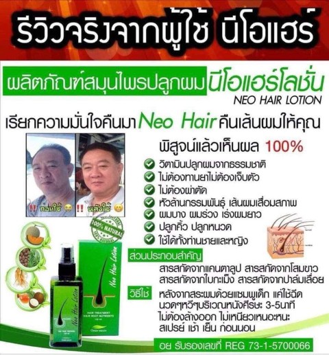 Vene Veneka เวเน่ เวเนก้า ผิวสวย สร้างผิวขาวฉ่ำ หน้าเด้งฟู Vicenza  antioxidants รูปที่ 6
