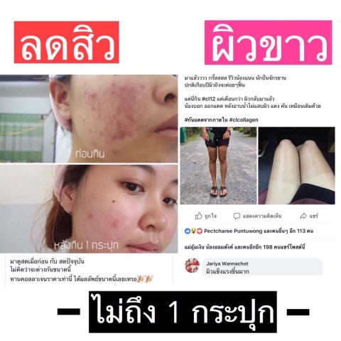 Miss one โลชั่นน้ำหอม โลชั่นน้ำหอมที่มาแรงที่สุด ใช้แค่ 1  ได้ถึงสองทั้งหอมทั้งบำรุงผิว รูปที่ 7