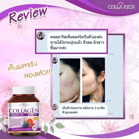 Collarich Collagen อาหารเสริมสำหรับผิวที่ดีที่สุด ช่วยลดสิว  ผิวกระจ่างใส รูปที่ 6