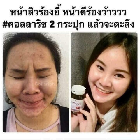 Collarich Collagen อาหารเสริมสำหรับผิวที่ดีที่สุด ช่วยลดสิว  ผิวกระจ่างใส รูปที่ 7