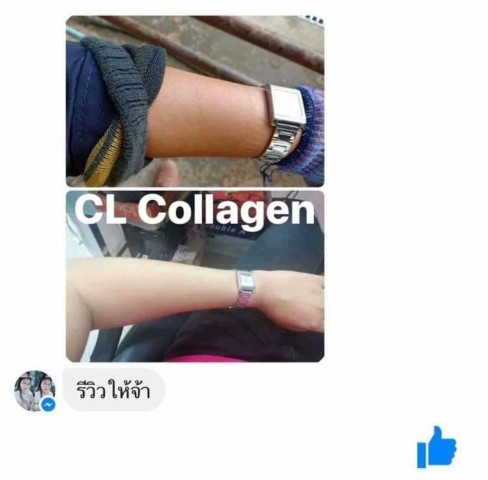 CL Collagen 12ซีแอล คอลลาเจน ตัวช่วยให้ผิวใสและลดสิว  สวยครบจบในตัวเดียว รูปที่ 6