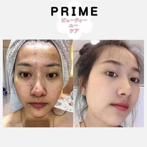 CL collagen ผิวสวยหน้าใส ลดสิว  เป็นคอลลาเจนที่ขายดีมาแรงสุด รูปที่ 7