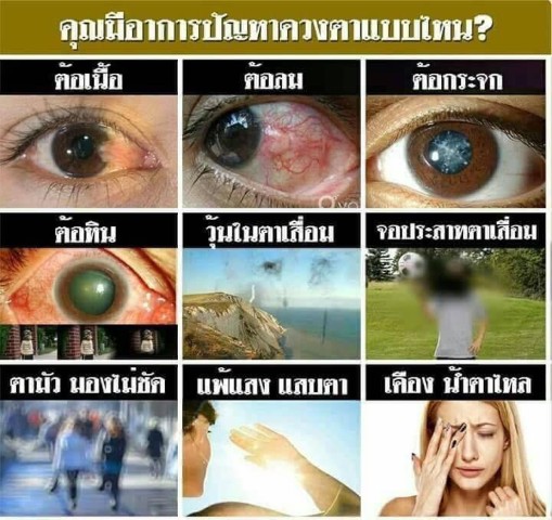 อาหารเสริมดวงตา ดีคอนแทค D contact ช่วยแก้ปัญหาตามัว เห็นภาพพร่า  ไม่แจ่ม มองไม่ชัด รูปที่ 4