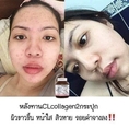 CL Collagen 12 Thailand ผิวขาวสว่างใส ไร้สิว ลดฝ้า