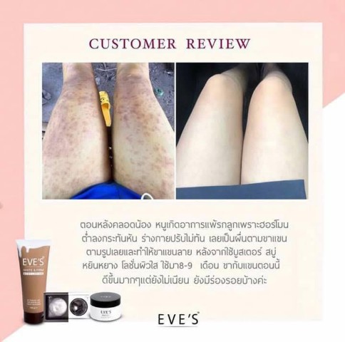 Eve s ผลิตภัณฑ์บำรุงผิวหน้าและผิวกาย ตอบโจทย์ทุกสภาพผิวหน้า ฝ้า กระ  หน้าหมองคล้ำ รูปที่ 3