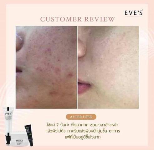 Eve s ผลิตภัณฑ์บำรุงผิวหน้าและผิวกาย ตอบโจทย์ทุกสภาพผิวหน้า ฝ้า กระ  หน้าหมองคล้ำ รูปที่ 6
