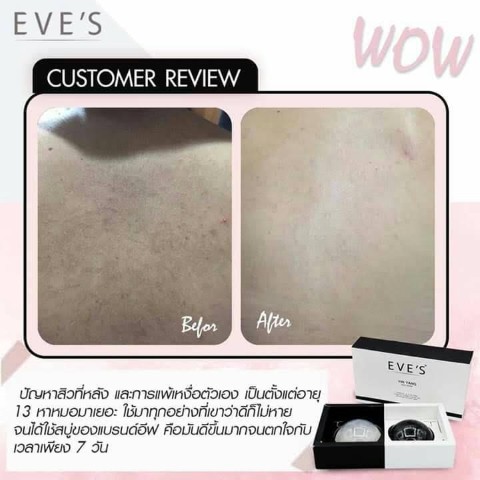 Eve s ผลิตภัณฑ์บำรุงผิวหน้าและผิวกาย ตอบโจทย์ทุกสภาพผิวหน้า ฝ้า กระ  หน้าหมองคล้ำ รูปที่ 7