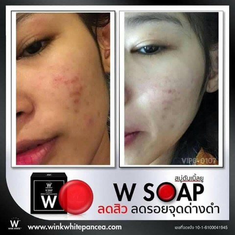 ศูนย์จำหน่ายผลิตภัณฑ์ วิงค์ ไวท์  ตอบทุกปัญหาความสวยความงามของคนไทย รูปที่ 7