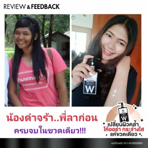 ศูนย์จำหน่ายผลิตภัณฑ์ วิงค์ ไวท์  ตอบทุกปัญหาความสวยความงามของคนไทย รูปที่ 3