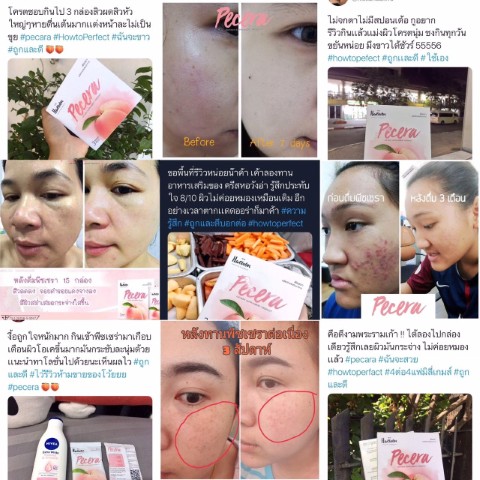 Pecera Collagen คอลลาเจนจากแหล่งดีที่สุดในโลก ที่คริส หอวัง  และน้องฉัตรเลือกใช้ รูปที่ 6