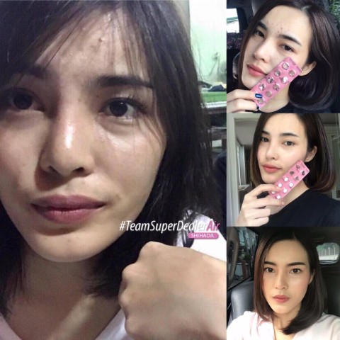 กลูต้า Shihada  ต้นตำหรับของกลูต้าไธโอนแท้ๆจากประเทศญี่ปุ่น รูปที่ 3
