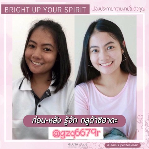 กลูต้า Shihada  ต้นตำหรับของกลูต้าไธโอนแท้ๆจากประเทศญี่ปุ่น รูปที่ 5