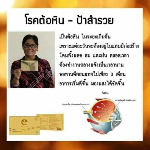อาหารเสริมเพื่อดวงตา ดีคอนแทค D-contact ปัญหาตามัว เห็นภาพพร่า  มองไม่ชัด แก้ไขได้ รูปที่ 7