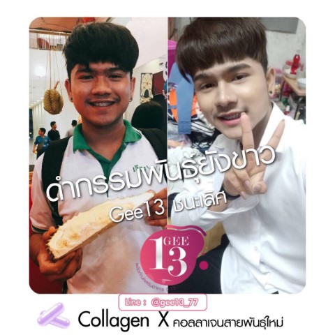 Gee13 Collagen จี13 คอลลาเจน สายพันธุ์ใหม่ ดีงามทั้งนั้น อยากสวยโบ๊ะ  พร้อมผิวสุขภาพดี รูปที่ 4