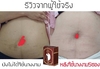 รูปย่อ เซรั่มรักแร้นางงาม อันดับ 1 ของเมืองไทย จบปัญหารักแร้ดำ  ช่วยปรับสภาพผิวให้เรียบเนียนขึ้น รูปที่6