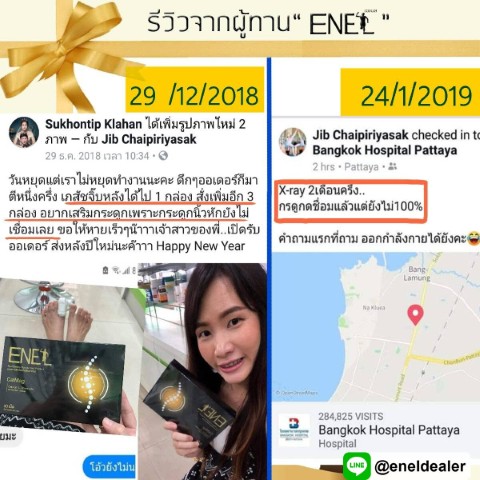 Enel CalMag เอเนล แคลแม็ก อาหารเสริมบำรุงกระดูก ไม่สะสม  ไม่ก่อให้เกิดหินปูนในร่างกาย รูปที่ 6