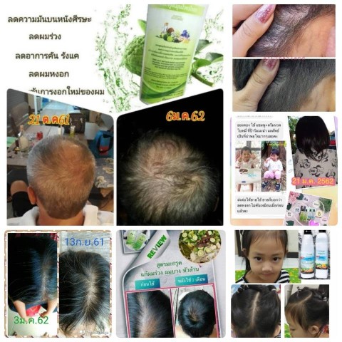 ผลิตภัณฑ์ดูแลผม แชมพู4YL เป็นแชมพูสมุนไพรสดแท้ๆ แก้ปัญหาผมร่วง ผมบาง  ผมแห้งเสีย รูปที่ 7
