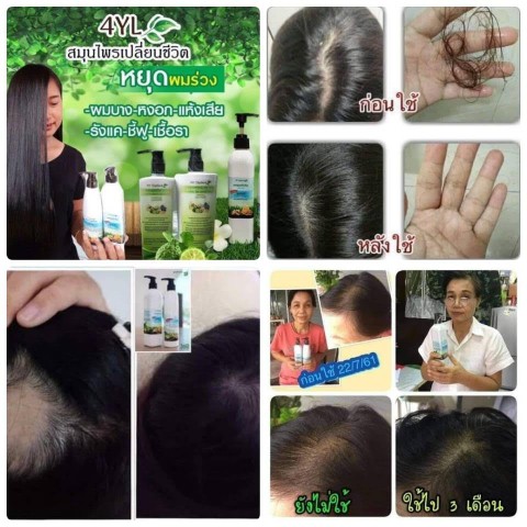 ผลิตภัณฑ์ดูแลผม แชมพู4YL เป็นแชมพูสมุนไพรสดแท้ๆ แก้ปัญหาผมร่วง ผมบาง  ผมแห้งเสีย รูปที่ 6