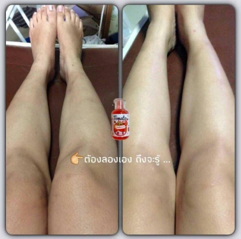 CL Collagen 12 ซีแอล คอลลาเจน ตัวช่วยให้ผิวใสและลดสิว  สวยครบจบในตัวเดียว รูปที่ 7