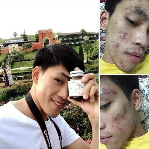 CL Collagen 12 ซีแอล คอลลาเจน ตัวช่วยให้ผิวใสและลดสิว  สวยครบจบในตัวเดียว รูปที่ 6