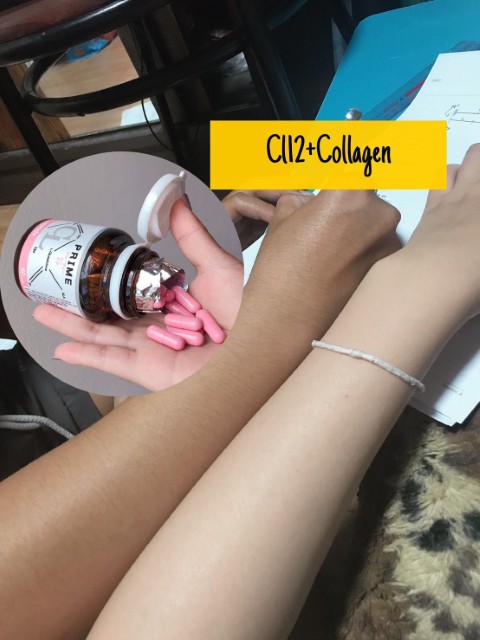 CL Collagen12 ซีแอล คอลลาเจน  ตัวช่วยให้ผิวใสและลดสิว สวยครบจบในตัวเดียว รูปที่ 4