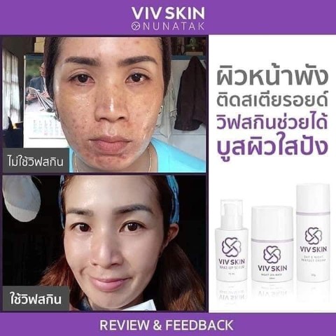 ผิวหน้าสวยใส รักษาสิวกับ จุ๋ย วรัทยา เคล็ดลับผิวใส ที่ใครๆก็อยากรู้ จุ๋ยเห็นว่าดี  ถึงกล้ามาบอกต่อ รูปที่ 6