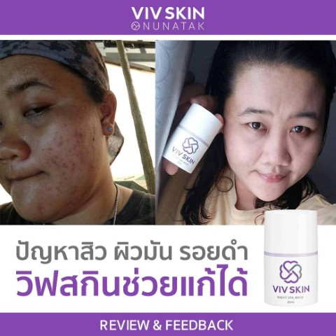 ผิวหน้าสวยใส รักษาสิวกับ จุ๋ย วรัทยา เคล็ดลับผิวใส ที่ใครๆก็อยากรู้ จุ๋ยเห็นว่าดี  ถึงกล้ามาบอกต่อ รูปที่ 7