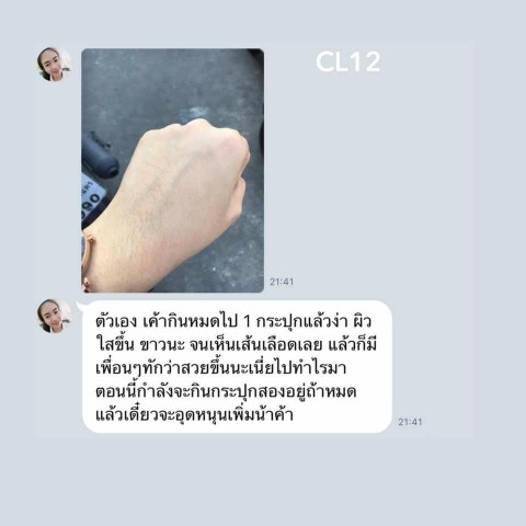 CL12 collagen ซีแอล คอลลาเจน ทั้งผิวใสและลดสิว สวยครบจบในตัวเดียว รูปที่ 6