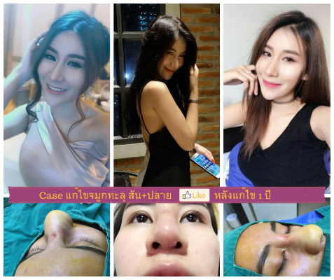 NATTAPONG CLINIC ณัฐพงษ์คลินิก อยากเห็นทุกคนมั่นใจใน รูปหน้าและผิวพรรณ รูปที่ 6