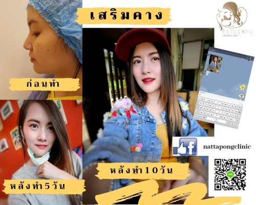 NATTAPONG CLINIC ณัฐพงษ์คลินิก อยากเห็นทุกคนมั่นใจใน รูปหน้าและผิวพรรณ รูปที่ 5