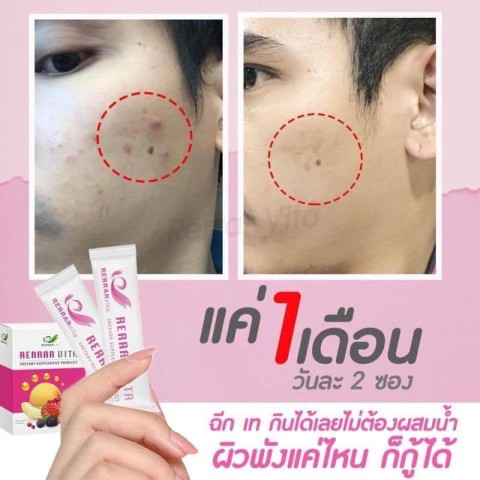 Rerrar Vita เร่อร่าไวต้า วิตามินอาหารผิว ลดเลือนริ้วรอย ผิวเต่งตึง ลดสิว  ผิวกระจ่างใส รูปที่ 7