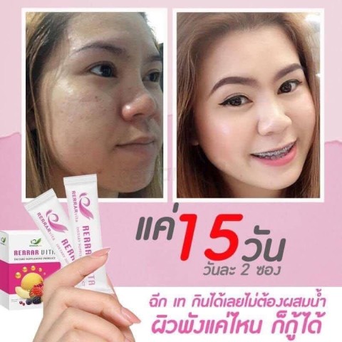 Rerrar Vita เร่อร่าไวต้า วิตามินอาหารผิว ลดเลือนริ้วรอย ผิวเต่งตึง ลดสิว  ผิวกระจ่างใส รูปที่ 5