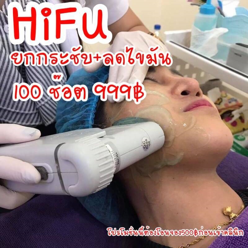 ULTRA HIFU ยกกระชับหน้าโดยไม่ต้องผ่าตัด ตัวใหม่ลงลึกกว่า Hifu ธรรมดา 4.5 เท่า 100shots 999฿‼️จาก1,900฿ รูปที่ 1